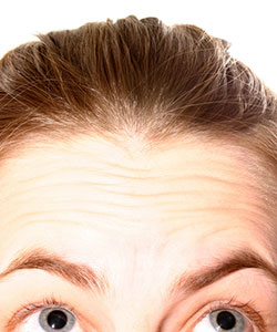Thinning Hair in Woman - Cause and Solution