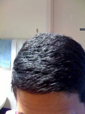 Extremely Dry And Dull Hair