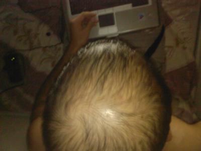 Top view of my head