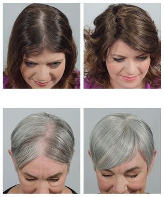 Snap in hair extensions for thinning hair and bold spots